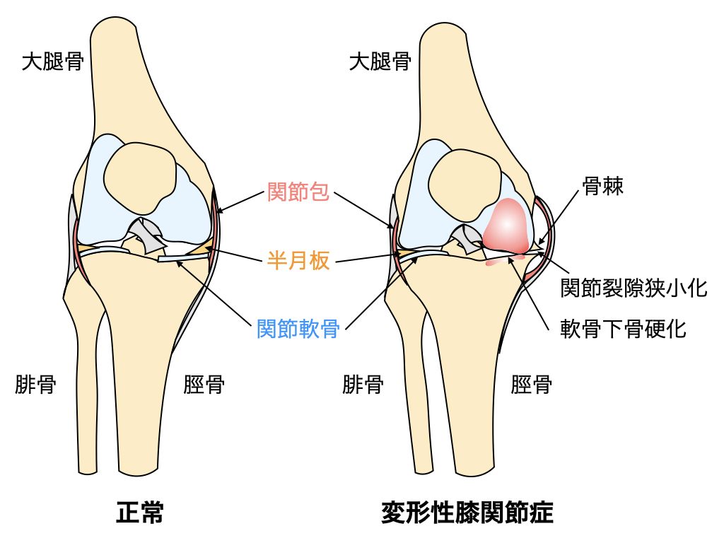整形外科 診療科目 各部門 社会医療法人垣谷会 明治橋病院 整形外科 診療科目 各部門 社会医療法人垣谷会 明治橋病院